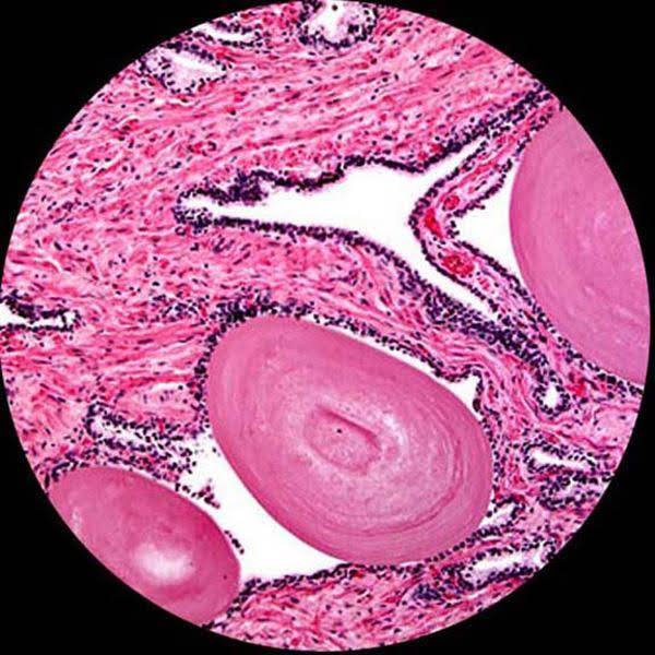 Trinocular Biological Compound Microscope with Plan Objectives and 14MP USB Digital Camera Z631374